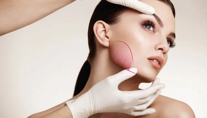 Tiêm Botox hàm: Giải pháp thon gọn khuôn mặt không cần phẫu thuật