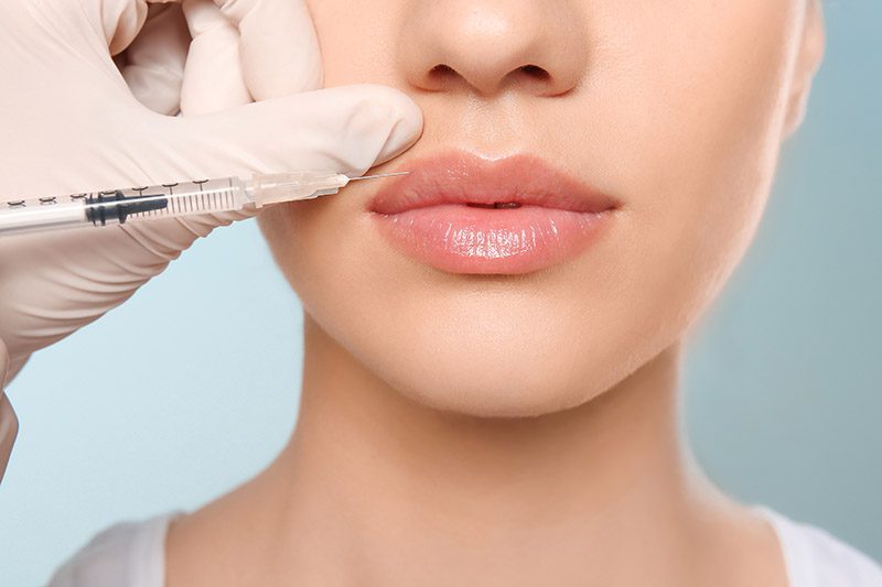 Tiêm tan filler: Giải pháp an toàn cho kết quả thẩm mỹ không mong muốn